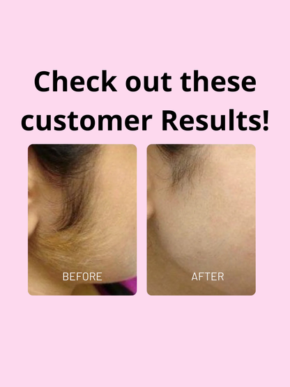 Bloomora Cyperus Rotundus Oil™ Natural Hair Reduction & Skin Soothing