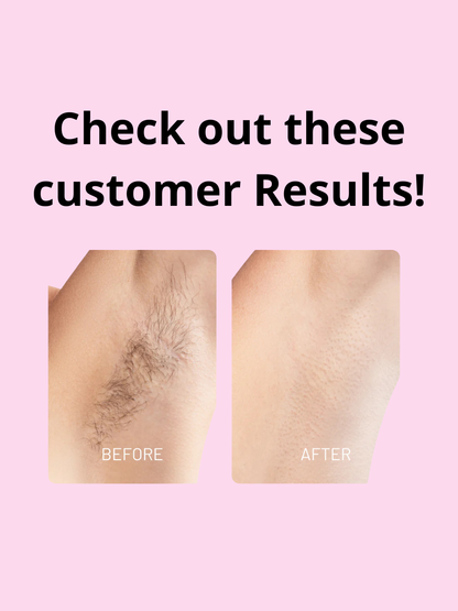 Bloomora Cyperus Rotundus Oil™ Natural Hair Reduction & Skin Soothing